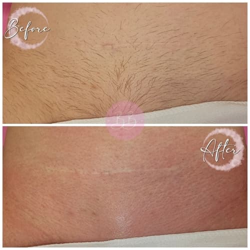 Waxing portfolio at Bare Beauty Essentials