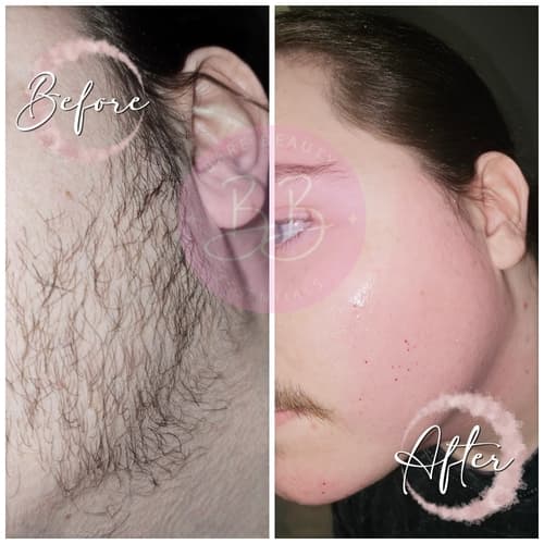 Waxing care at Bare Beauty Essentials